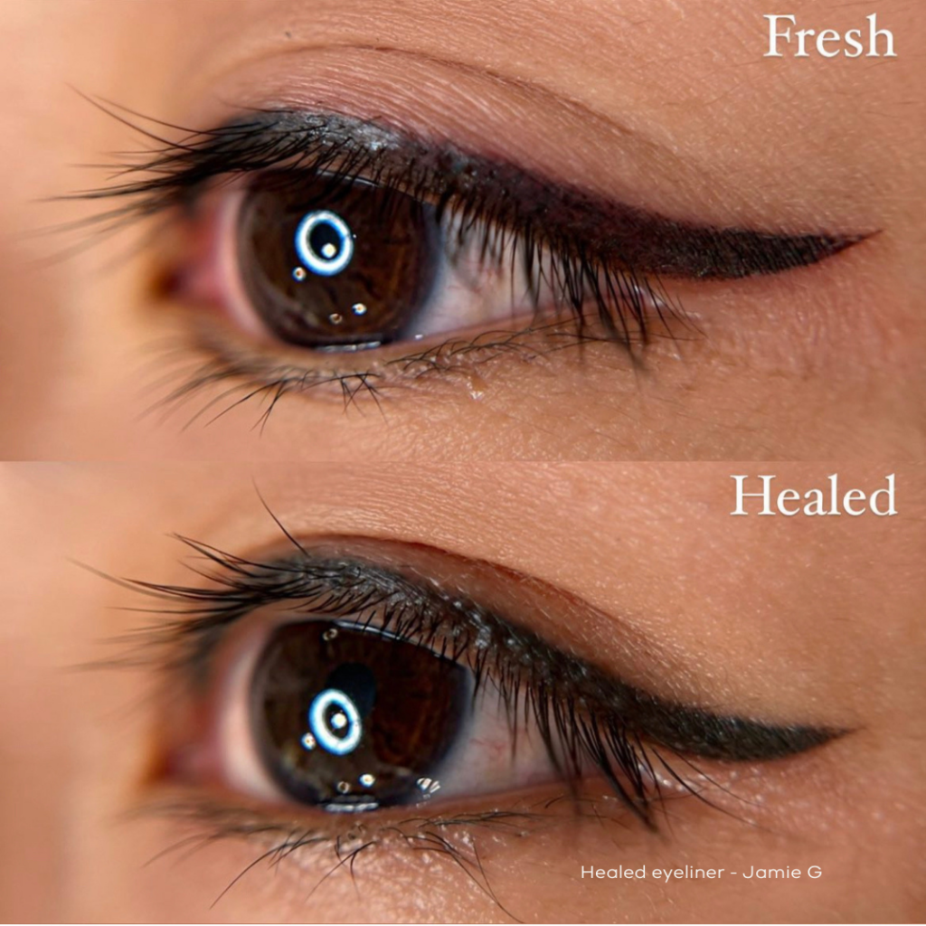 Healing Balm-before and after use of healing balm on the eyelid